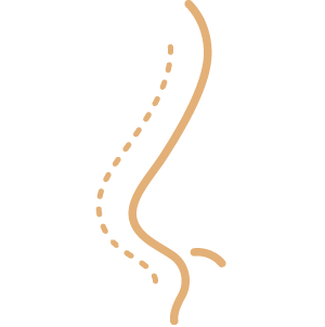 Rinoplastica